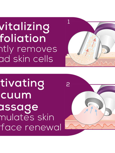 Microdermabrasion, FC76